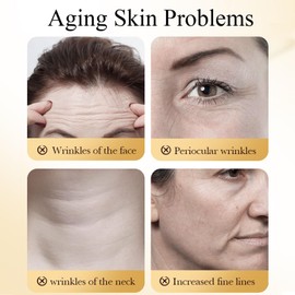 ARCHIDATE Bee Venom Facial Mask, Deep Hydration, Smooth & Soften, Reduce Wrinkle and Fine Lines, Enhance Skin Firmness and Elasticity, Anti-wrinkle Bee Venom Lifting Mask for Women All Skin Types