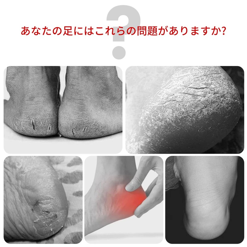 RICISUNG 2足セット かかとケア かかと 靴下 ソックス ひび割れ 角質ケア 保湿 足のかかと