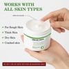 Urea Cream 60 Percent For Feet, Feet Cream with Salicylic