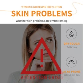 Vitamin C Body Lotion – Brightening & Hydrating Body Moisturiser – Vitamin C Cream for Uneven Skin Tone – Smooth, Radiant & Nourished Skin – Daily Body Care for Dry & Dull Skin 300ml