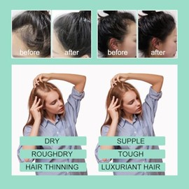 Aceite de Romero,Aceite de Romero para El Cabello,aceite para el cabello,Promover el crecimiento del cabello, apto para pestañas, cejas y cabello daña