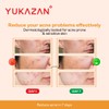 Yukazan Derma Refining Cream Acne & Pore 30ml Acne Removal