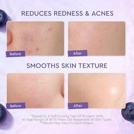 crema facial con 5X Ceramides y Blueberry, crema para la barrera de la piel con hidratación profunda, 100 g
