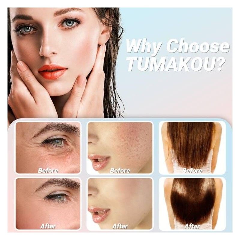 TUMAKOU High Frequency Stick Face - High Frequency Device Acne