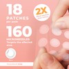 PatchRx Micro Needle Pimple Patch (18 Pack) - Hydrocolloid Micropoint