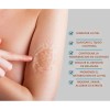 Crema Despigmentante Manchas Melasma Cicatrices Paño Y Acne