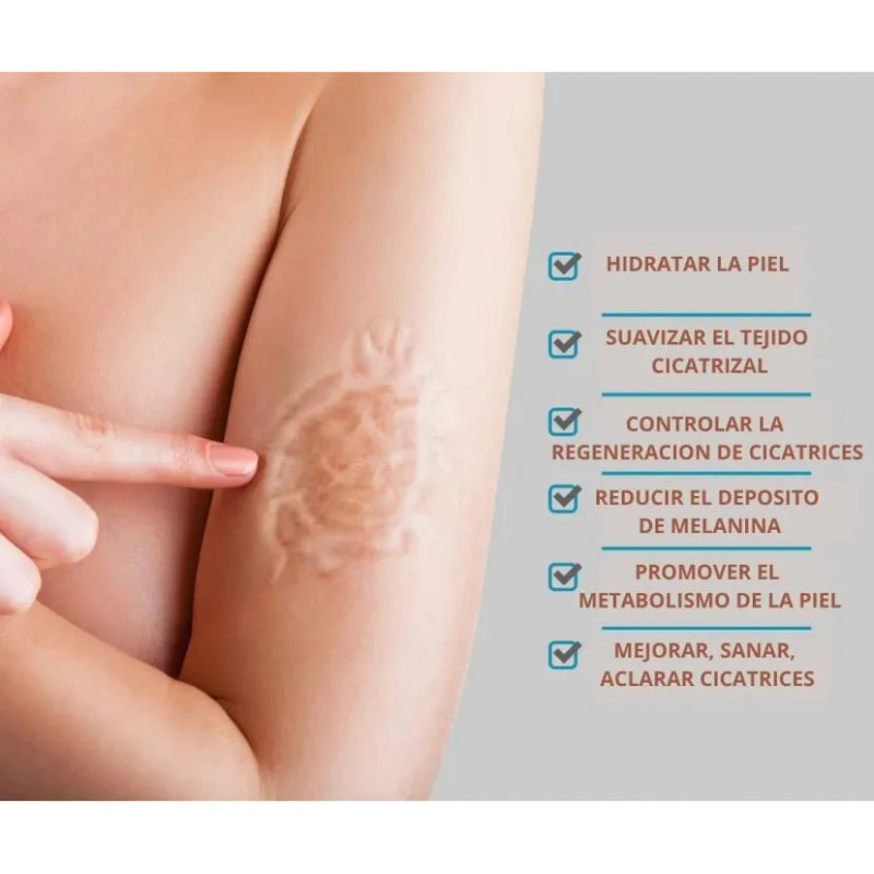 Crema Despigmentante Manchas Melasma Cicatrices Paño Y Acne