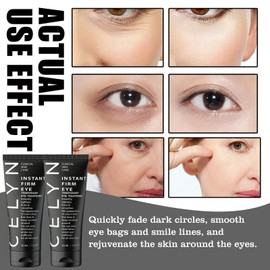 2PCS Celyn Instant Eye Tightener,Celyn Eye Bag Cream,Dark Circles Under Eye Treatment Women,Instant Firming Eye Cream,Under Eye Cream Fade Fine Lines,Tightens Eye Cream Anti Aging for Puffy Eyes