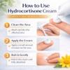 Hydrocortisone Cream 1% w/w Bite and Sting Cream, Mosquito and