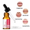 Dyceittdia Lip Oil, Lip Care Oil, Natural Lip Oil, Exfoliating