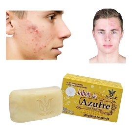 Jabón Azufre Aloe Vera Prosa Limpieza Profunda