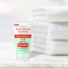 Exfoliante para el acné, sin aceites de Neutrogena Power-clear, control