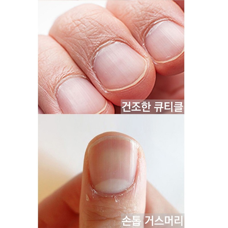 Microcell Microcell Cuticle Serum Comfort Two-in-One 15ml
