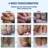 Sefudun Natural Plant Drops for Nails Care Tea Tree and