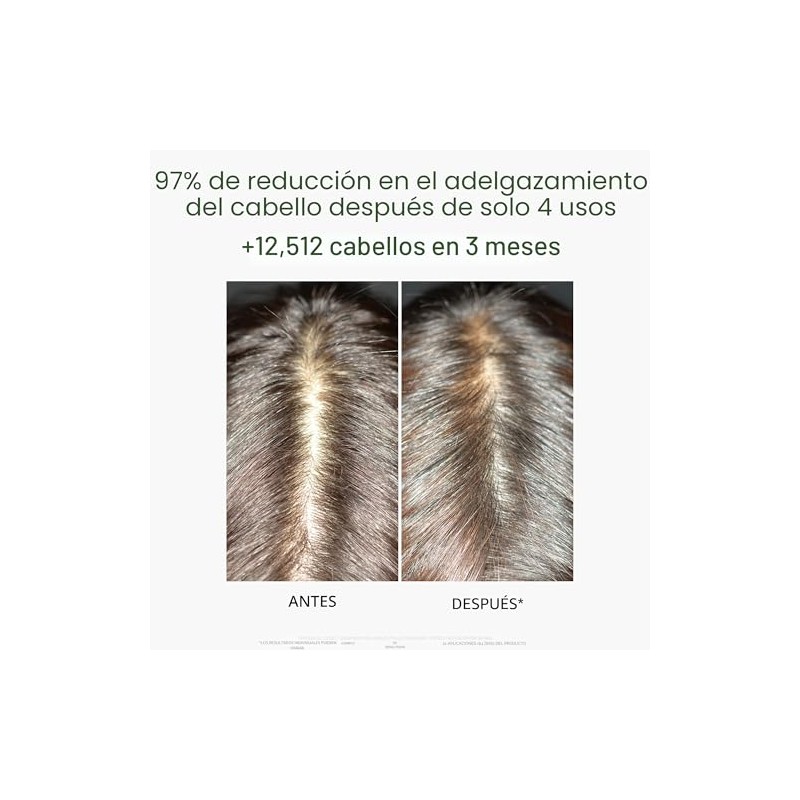 Rene Furterer TRIPHASIC - Cabello adelgazante reaccionario
