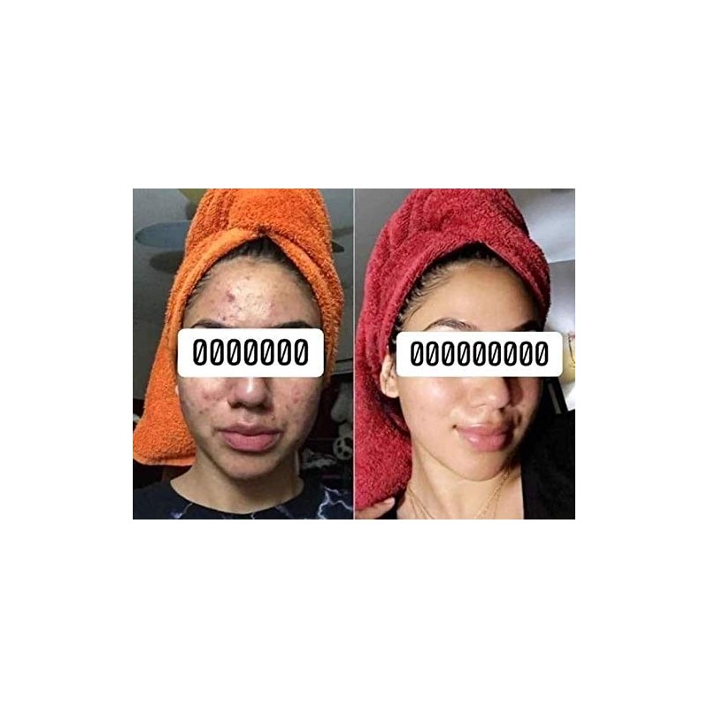 Kit anti-acné Sheló NABEL - Limpia y cuida tu rostro