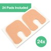 ZenToes U-Shaped Felt Callus Pads | Protect Calluses from Rubbing