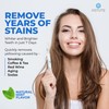 Astute Teeth Whitening Pen - Instant Tooth Whitener with Up