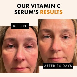 Suero Facial Con Vitamina C, Ácido Hialurónico, Ácido Ferúli