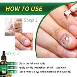 3PCS Ginger Nail Serum, Ginger Nail Serum, Cuticle for Nails, Nutrient Oil Strengthener Oil