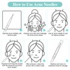 Coptiner 5pcs Pimple Tool Set Acne Blackhead Remover Extractor Tools