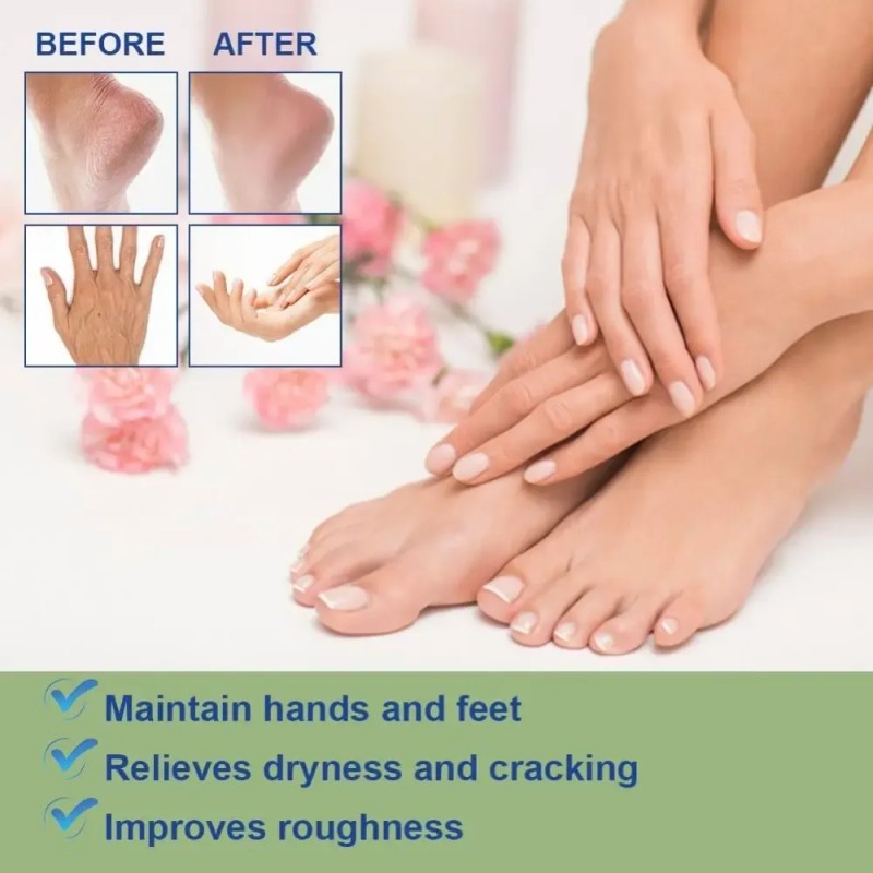 Wy Ss /crema Acwoo Con 60% De Urea, Crema For