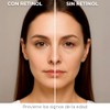 Kit Belleza Nocturna Crema Retinol, Serum Retinol Antiedad Antiarrugas