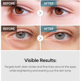 Dr.Melaxin Tx Tranexamic Acid Retinalsome Dual Eye Cream with Adenosine Niacinamide for Dark Circle Repairing Daily Anti-Aging Under Eye Care 50Ml - Korean Skin Care