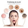 Lapiz De Plasma Electrico Remueve Verrugas Granos Vph Unisex