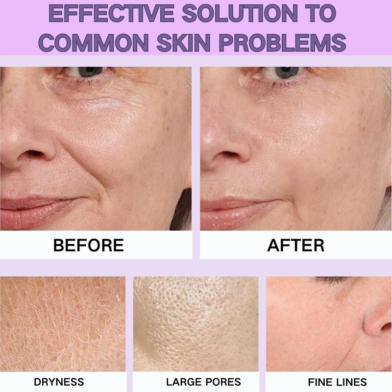 Bakuchiol Serum for Face - Bakuchiol Serum with Niacinamide for