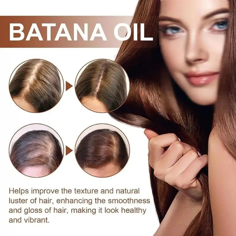 Champú Batana, Crecimiento Del Cabello.2pcs 2pcs