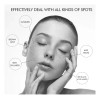 Crema For Eliminar Manchas Oscuras Y Manchas For Melasma Y