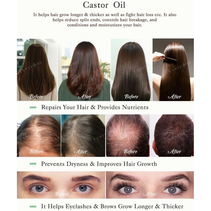 Pestaña Aceite De Ricino, Aceite Para El Crecimiento Cabello