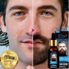 Tratamiento Para Crecimiento De Barba Y Bigote