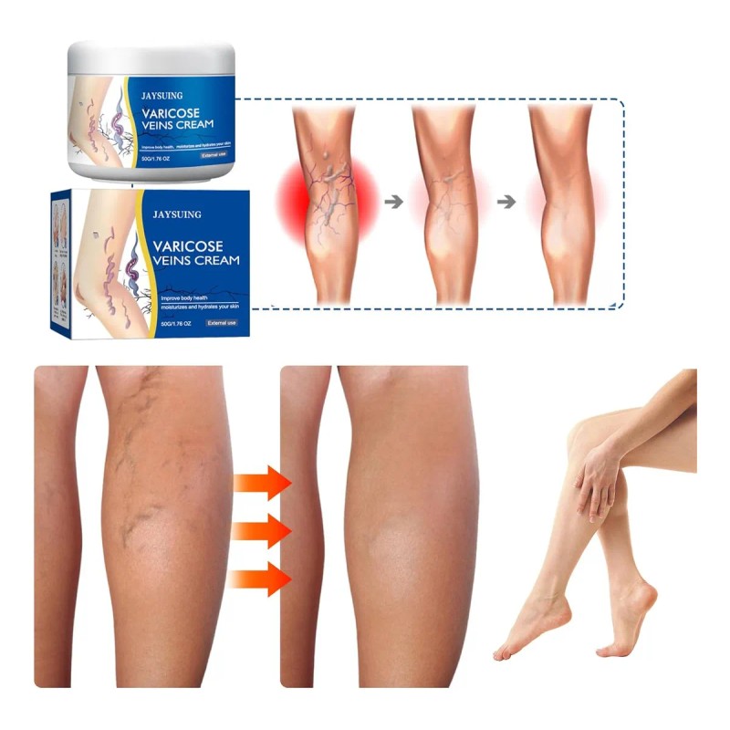 Cuidado Corporal Calmante Para Piernas, Crema Externa Para A