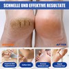 60% Urea Cream Foot Cream for Cracked Heels and Dry