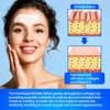 SILKDERMIS Forehead Wrinkle Patches 12Pcs with Aloe, Collagen, Vitamin E,