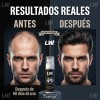 LWMaster - Kit 2 Tónico capilar Capixil 20% Anti-Caída estimula