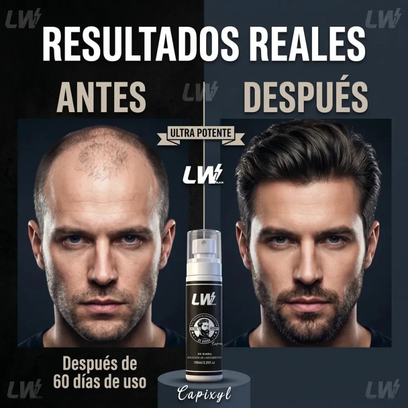 LWMaster - Kit 2 Tónico capilar Capixil 20% Anti-Caída estimula