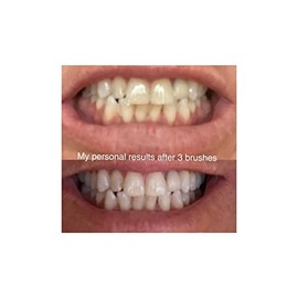 Farmasi Whitening Pasta de Dientes 112g