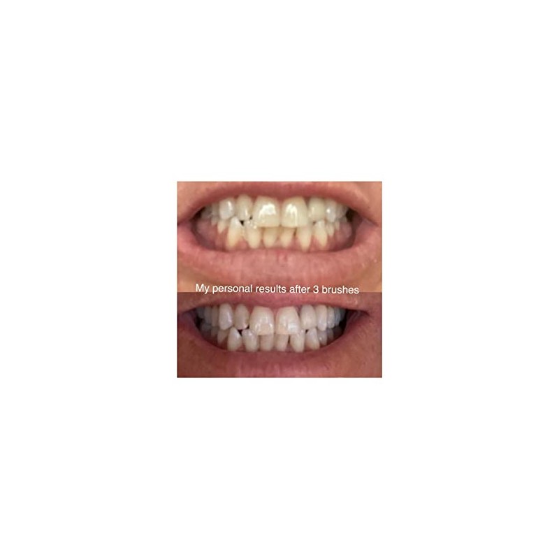 Farmasi Whitening Pasta de Dientes 112g