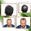 vidalforce KERATINA Fibres to conceal the Baldness – 27.5 Gr