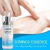 Dark Spot Remover for Face and Body, Enriching Skin Care
