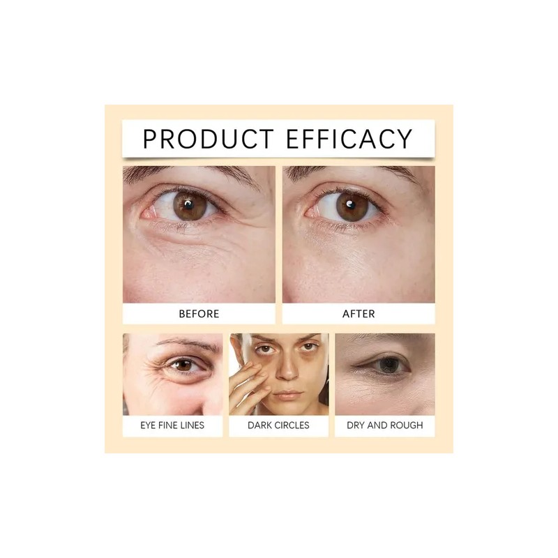 Suero Ruy Vc, Reduce Bolsas Y Ojeras.