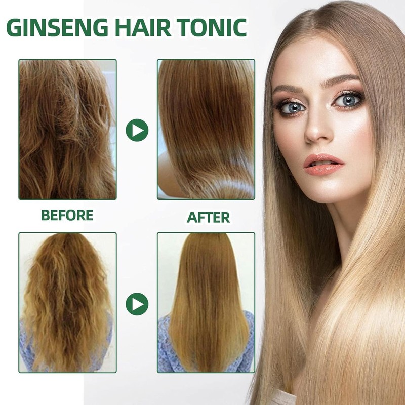 Vrpshe Vrpshe Hair Growth Spray, Para El Crecimiento Del Cabello,
