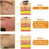 , Crema De Tratamiento, Crema Profesional Para El