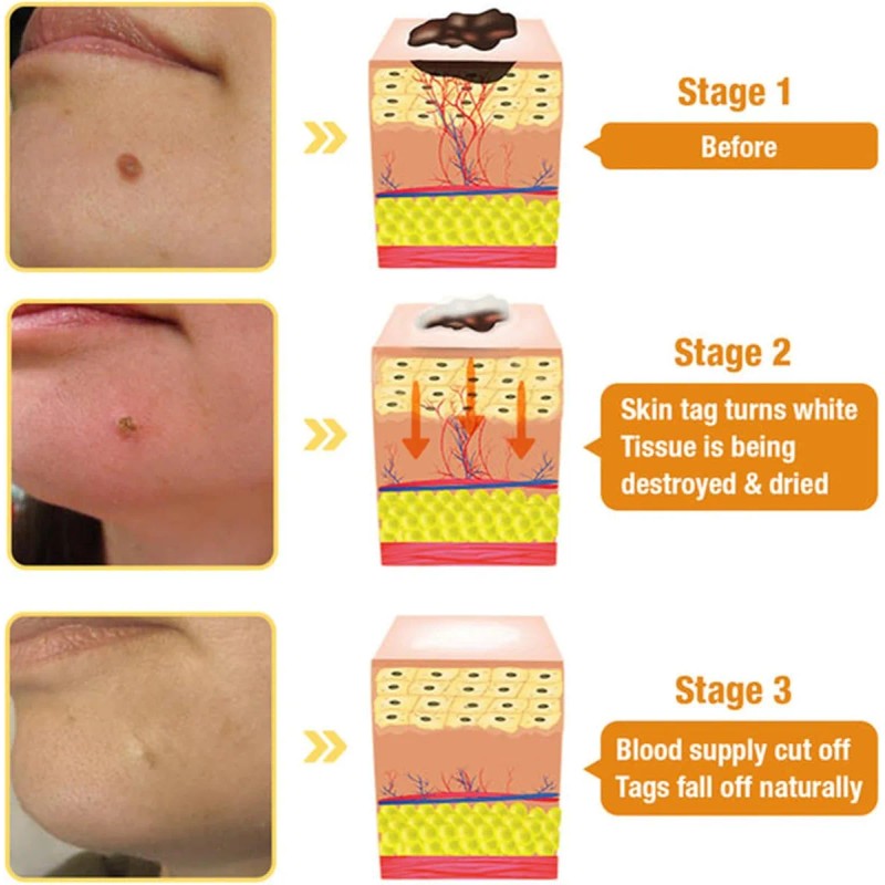 , Crema De Tratamiento, Crema Profesional Para El
