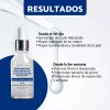 She Is Skincare Sérum Antiedad Doble Ácido Hialurónico + B3