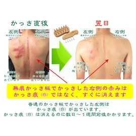 No Marks perfect-fitting and Plate perfect-fitting is no marks or (on plate