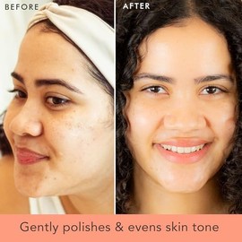 Exfoliante facial y lavado facial, exfoliante suave, exfoliante facial limpiador, ingredientes naturales y orgánicos